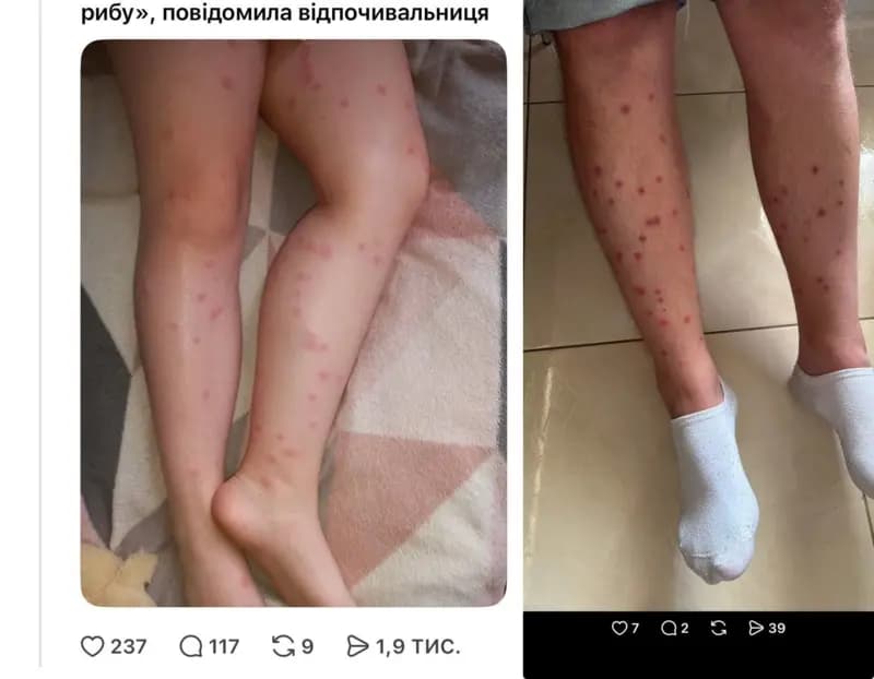"Усі чухаються": що відбувається на Світязі