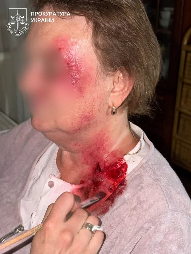 Известный киевский хирург заказал убийство экс-жены, с которой прожил 33 года